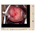 Colposcopie Software Voor 29620, 29622, 29600 Met 29603