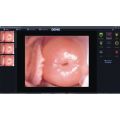 Colposcopie Software Voor 29624, 29625